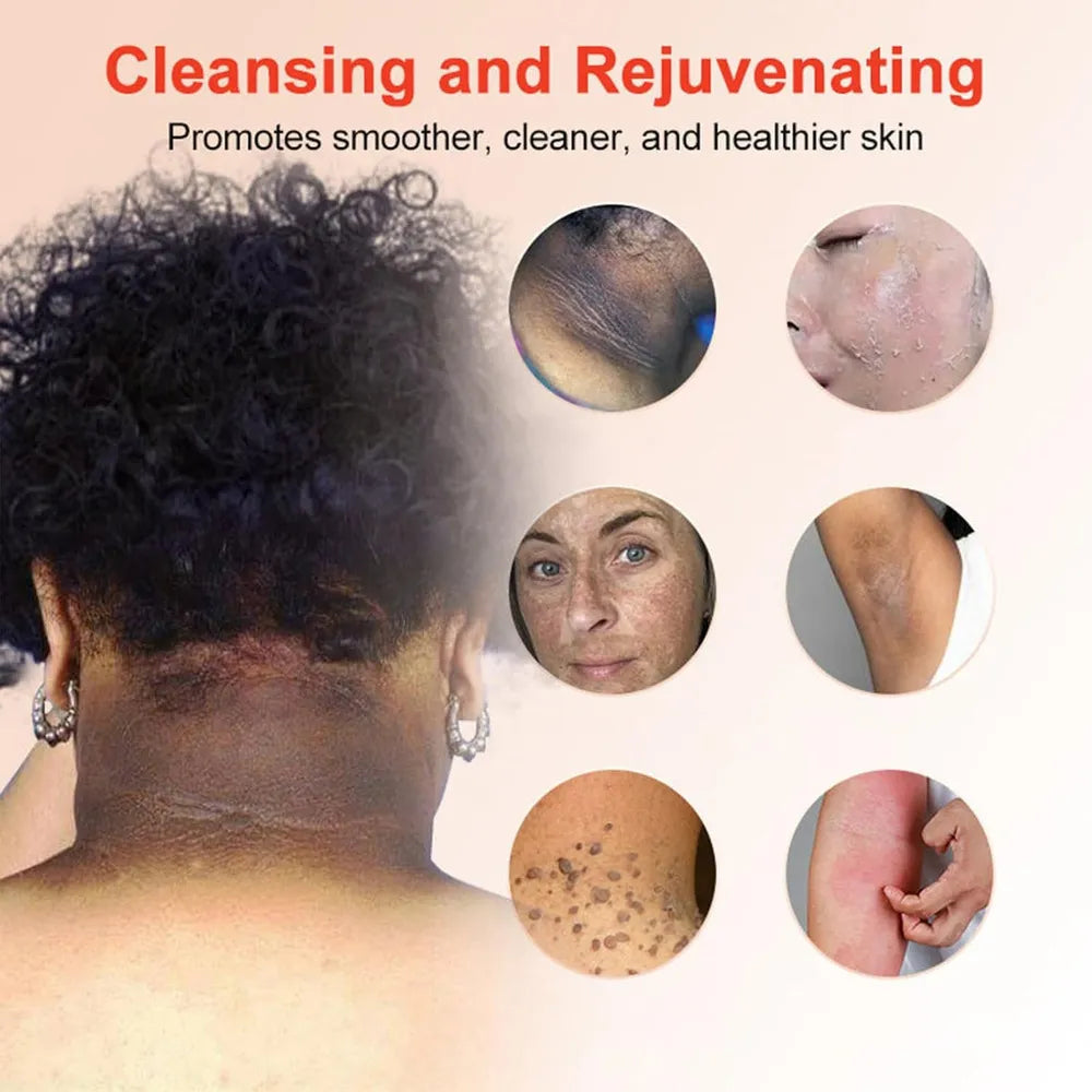 Quarxery 30ML Gel Exfoliante