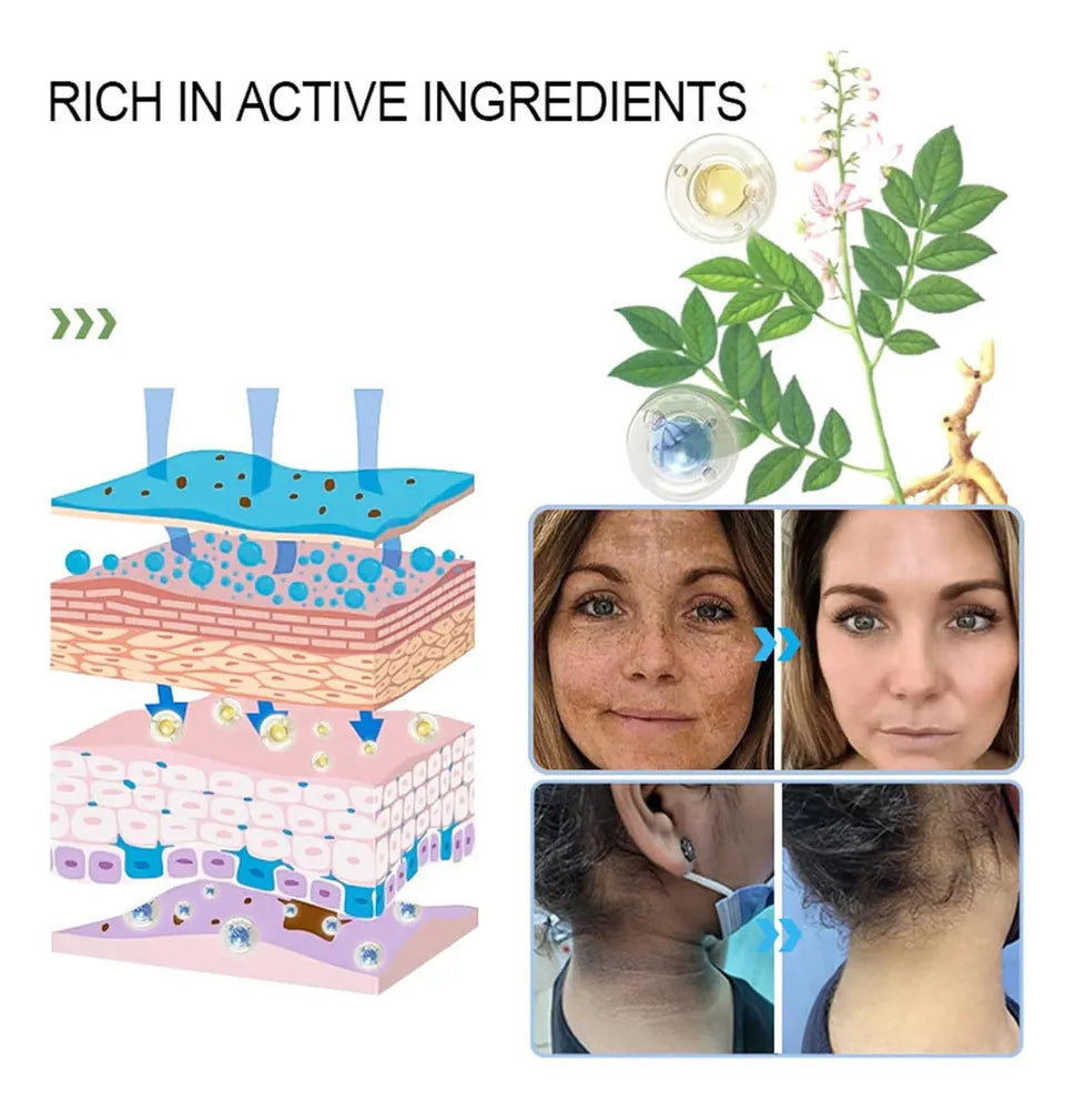 Quarxery 30ML Gel Exfoliante