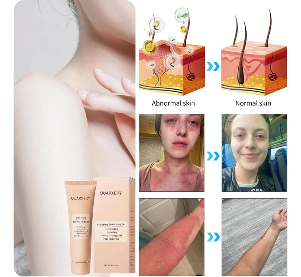 Quarxery 30ML Gel Exfoliante