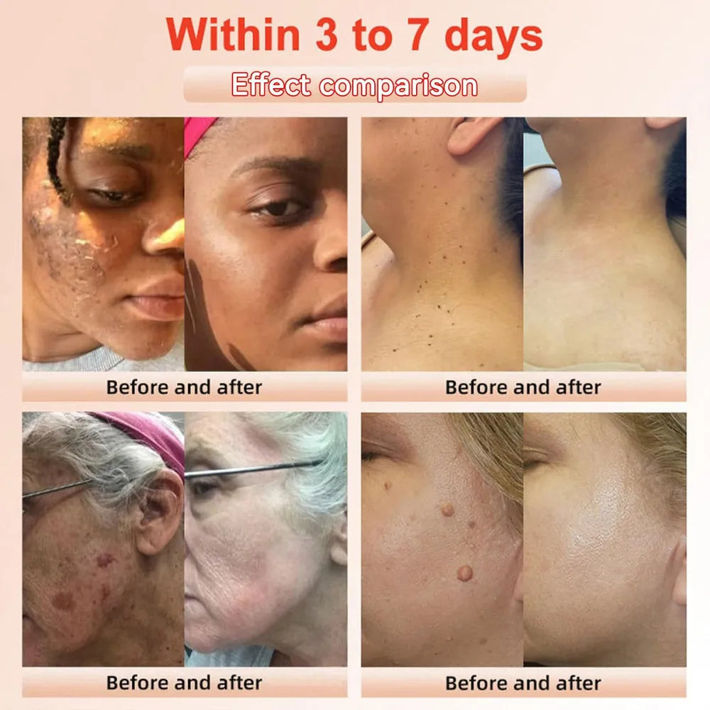 Quarxery 30ML Gel Exfoliante